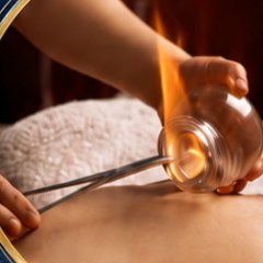 Cupping therapy at Maitri Liverpool